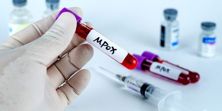 GHS Confirms 37 New Mpox Cases, Total Rises to 409